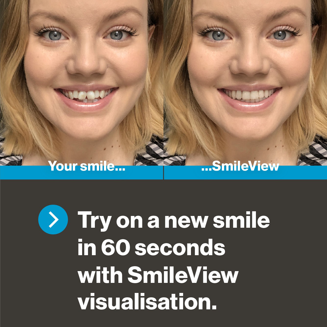 Cosmetic dental treatment Invisalign teeth straightening simulation